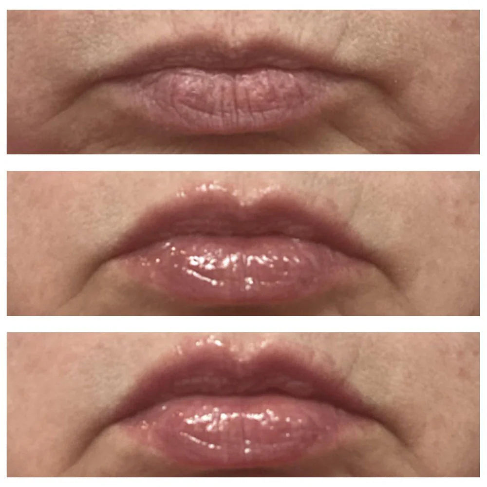 Instant Lip Plumper
