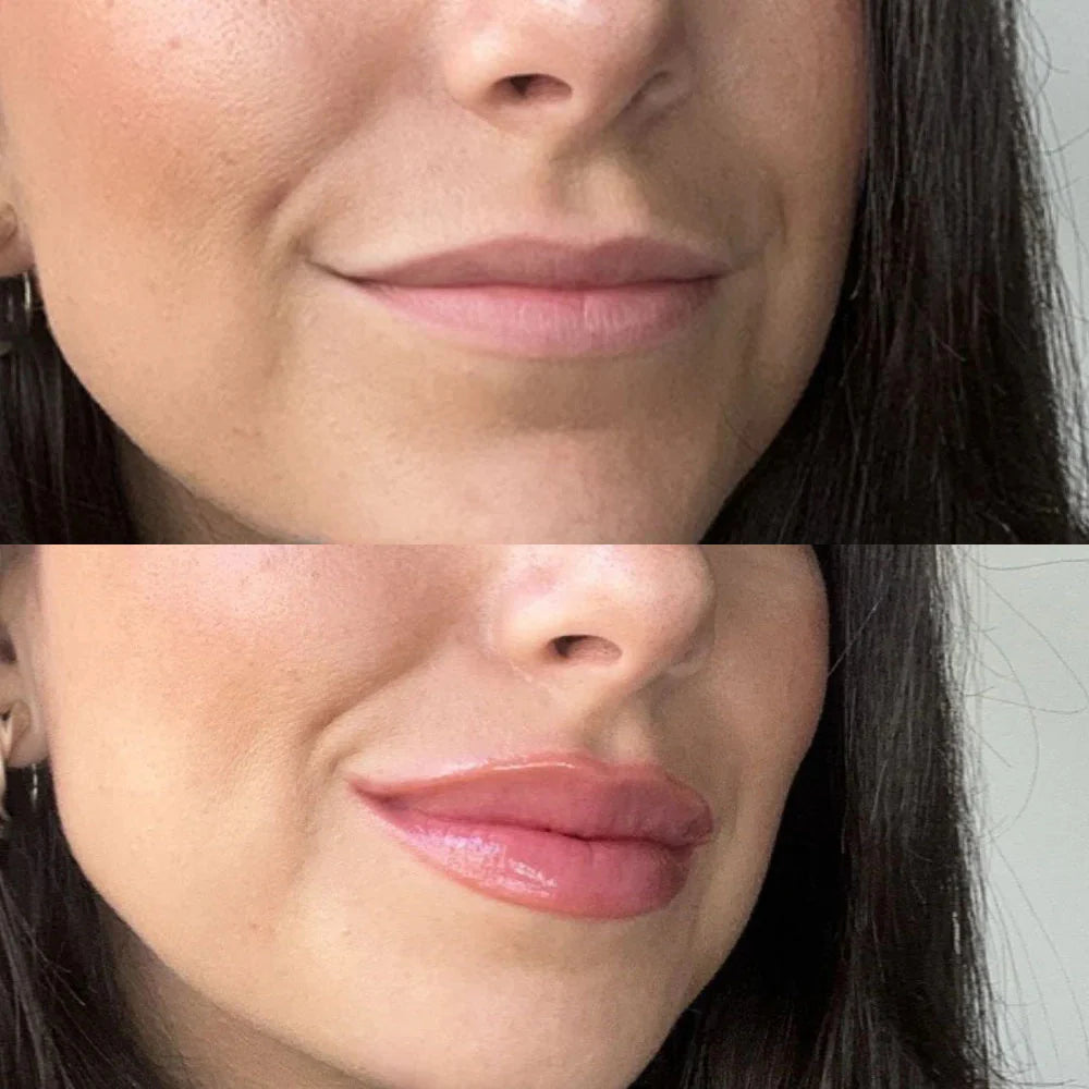 Instant Lip Plumper