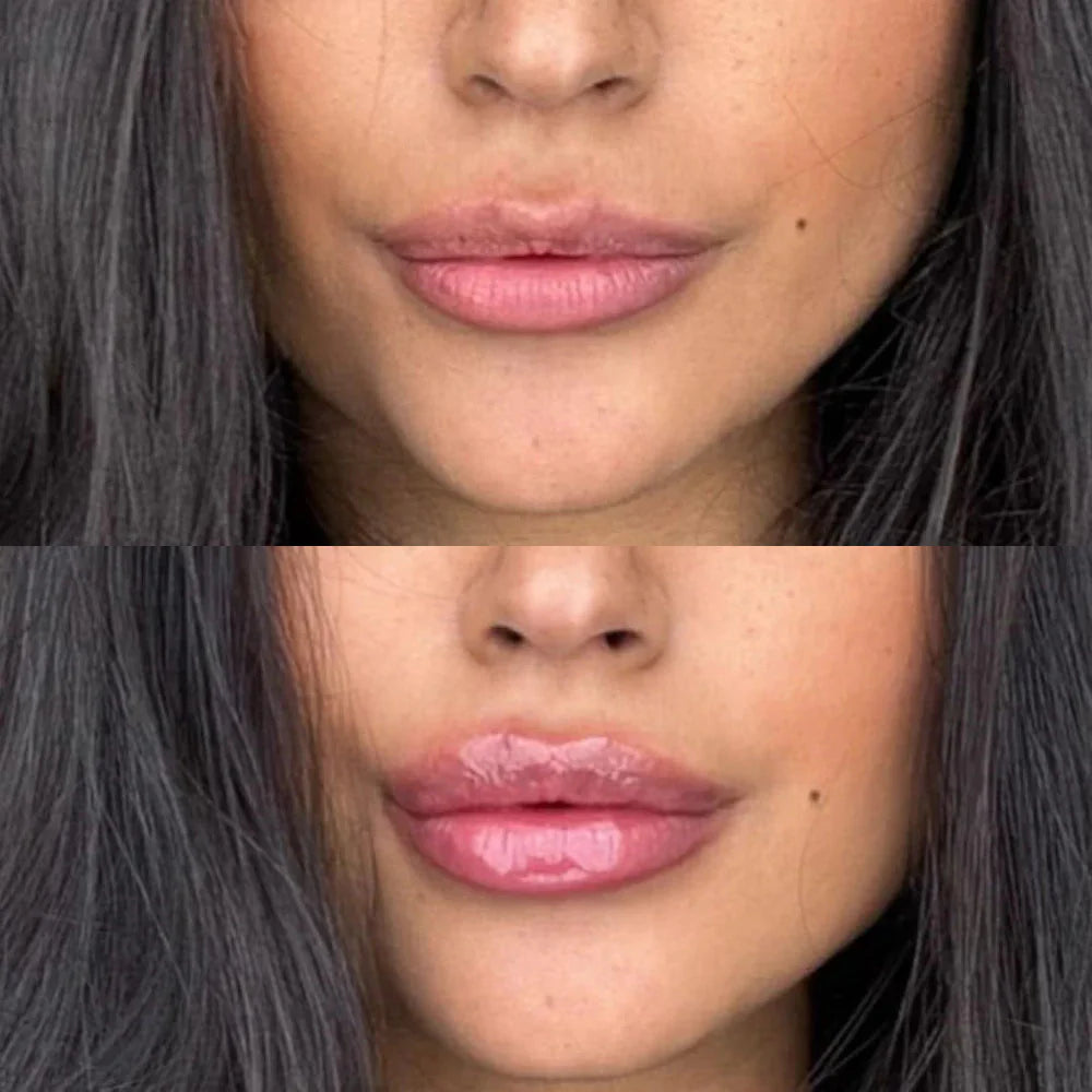 Instant Lip Plumper