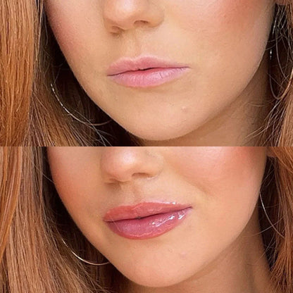 Instant Lip Plumper